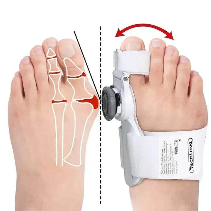 Universal Toe/Bunion Corrector - SMWSHOP