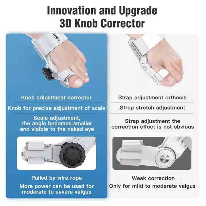 Universal Toe/Bunion Corrector - SMWSHOP