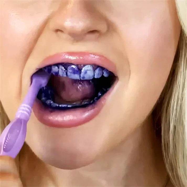 Smilekit Purple Whitening Toothpaste – Transform Your Smile - SMWSHOP